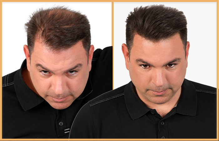 Kapilab hair fibers resultaten man